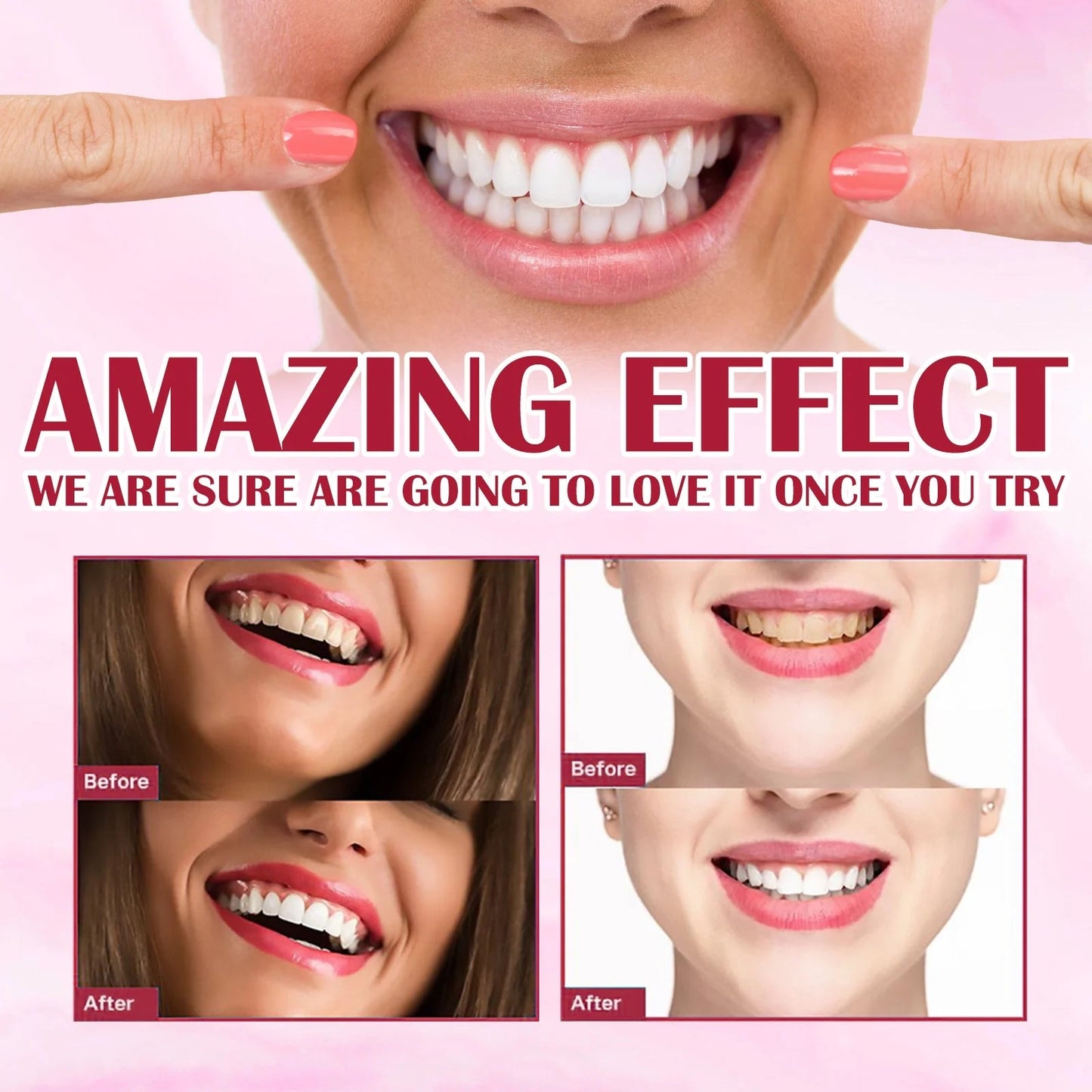 Yayashi SP4 Oral Care Probiotic Whitening Toothpaste 120g – Shine Brighter, Remove Years Of Coffee, Tea & Smoking Stains