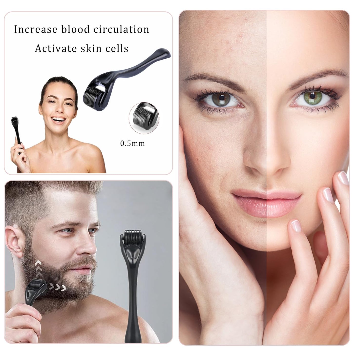Derma Roller System