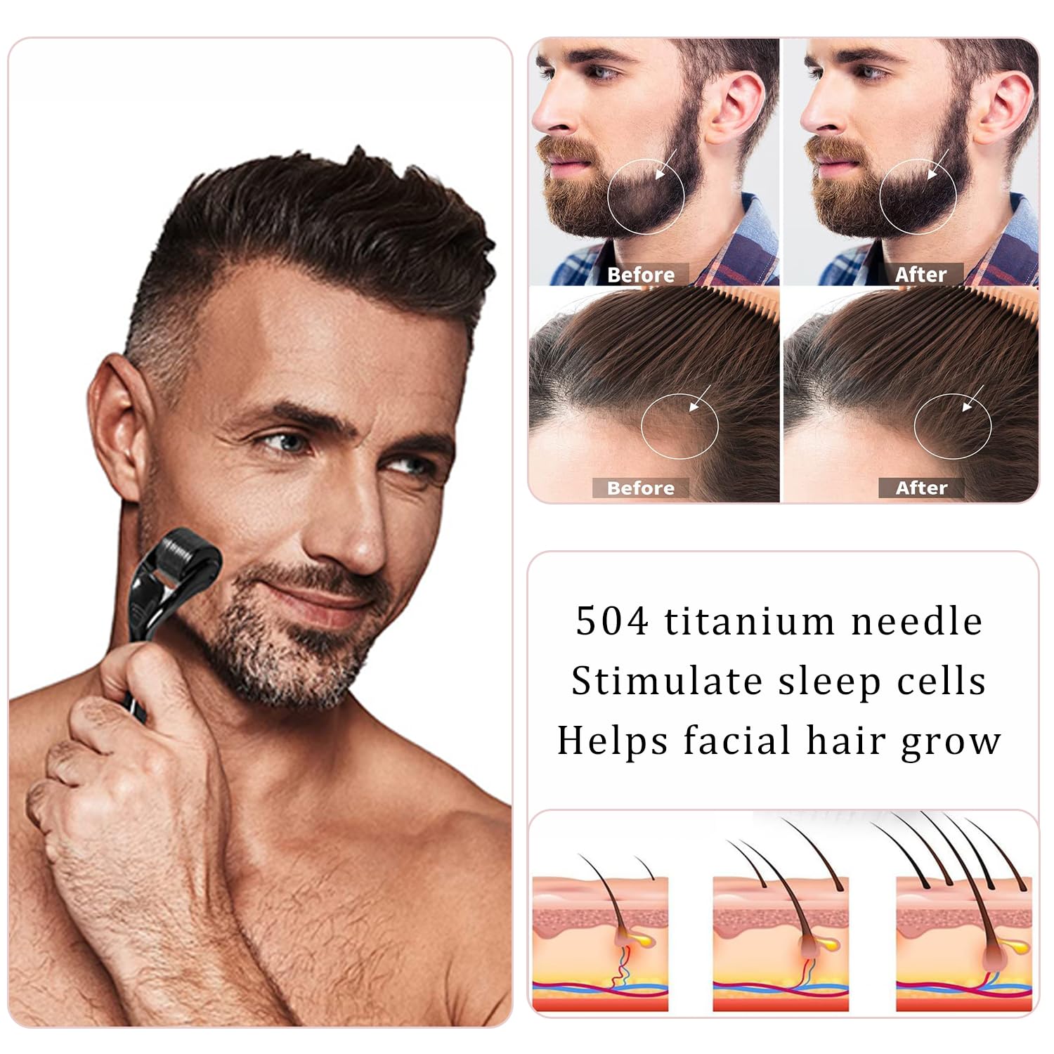 Derma Roller System